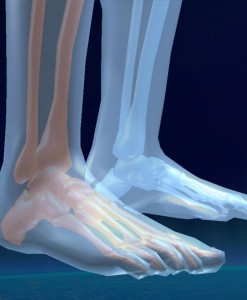 Feet - Cascade Orthotics Calgary