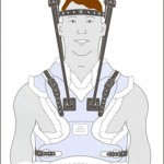 Cascade Orthotics: halo