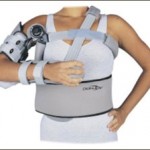 Cascade Orthotics: upper-arm