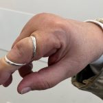 Cascade Orthotics: finger-orthoses